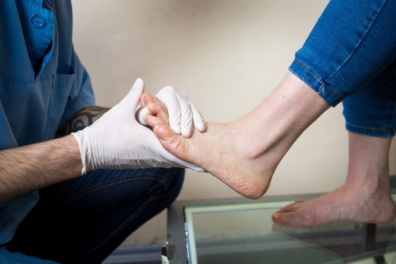 معاینه مچ پا جهت تشخیص شکستگی